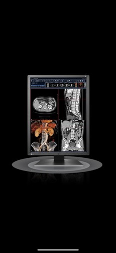 Eizo radiforce rx250 inch - rx250, 21.3-inch
