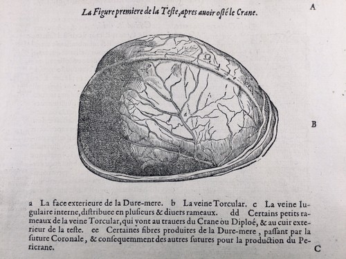 Neurologie anatomie cerveau - neurologie,