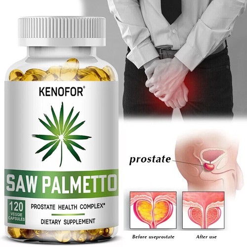 Saw palmetto complément - saw, –