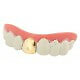 Dentier dent - dent, or