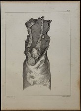 1839 - Planche d'anatomie -