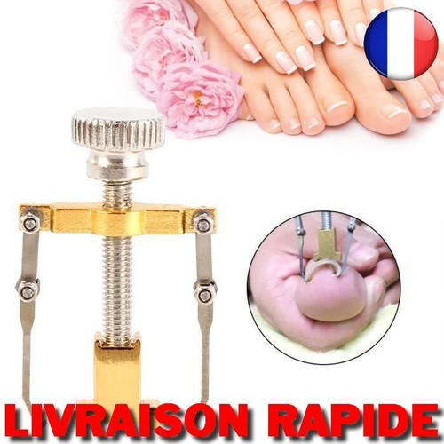 Traitement incarné ongle - traitement,