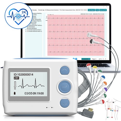 Moniteur ecg 24h portable - ecg,