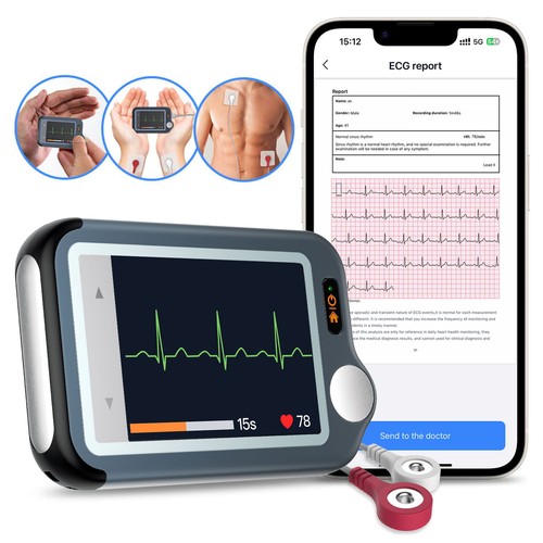 Checkme moniteur cardiaque - checkme,