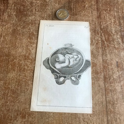 Ancienne gravure anatomie n102 - ancienne,