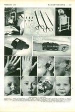 Cabinet of Curiosities Human Anatomy Radium Therapy Book Issue 1952