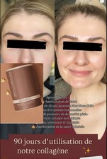 collagène Radiance  Simon Ourian fini le cortisol, Anti Stress