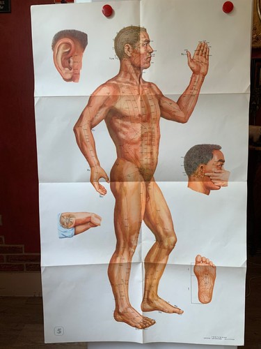 Ancienne affiche medicale - affiche,