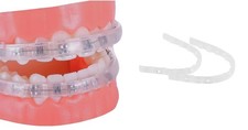 Protège-Lèvres Pour Appareil Dentaire - remplace la Cire Orthodontique - Prot...