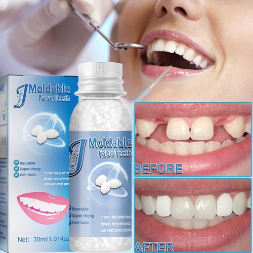Fausse dent provisoire - dent, en