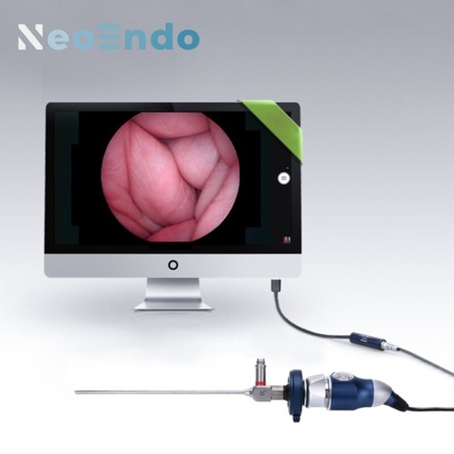 Medical portable endoscope - medical,