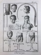 Chirurgie Artériectomie 1779 Bandage Ophtalmologue Médecine Encyclopédie Diderot