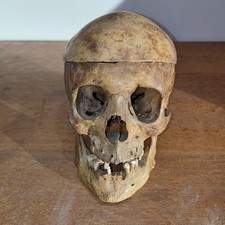 Ancien Crâne Humain,Anatomie, Faculté De Médecine,Curiosité,Cabinet De Curiosité