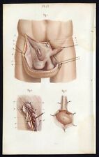 Cabinet of Curiosity Poster Board A3 3 Human Anatomy Surgery No.1 Men
