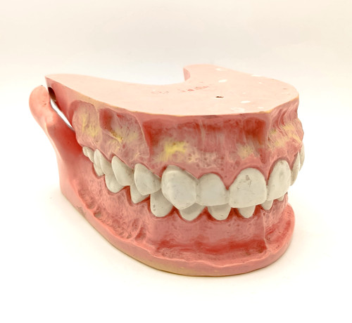 Mâchoire dentier publicitaire - mâchoire,