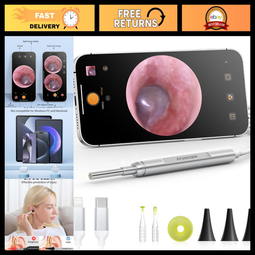 Digital otoscope for - otoscope,