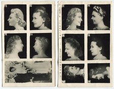 2 Photos - Cosmetic Surgery - 1950's Advertising - Vintage Silver Print 