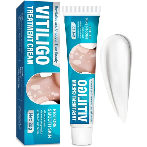 Vitiligo cream for white spots - cream,