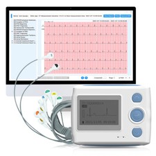 Moniteur ECG 24 heures sur 24 avec rapport d'analyse AI ECG avec APP gratuite