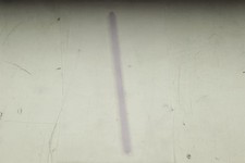 Lumenis Versapulse Nd:YAG