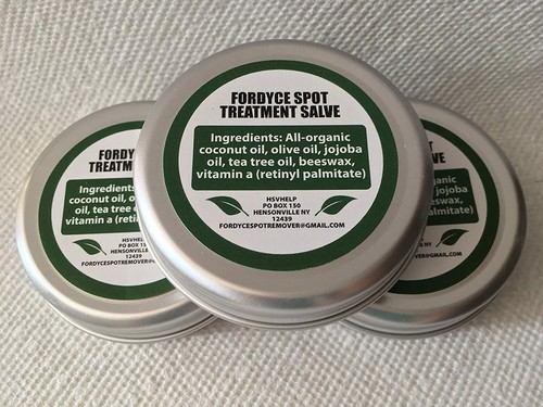 Fordyce spots treatment - fordyce,