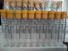 Prp Tubes Acd Solution Test