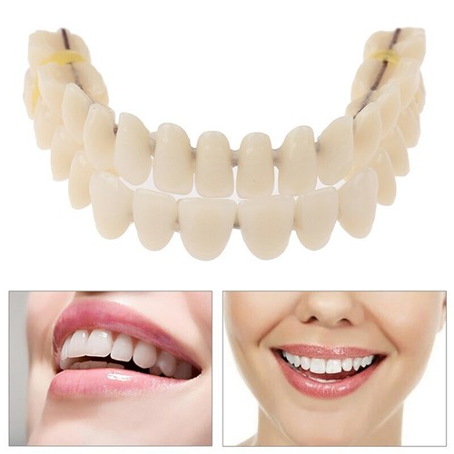 Dentier cosmétique facettes - dentier,