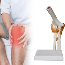 Modèle de Squelette Conjoint