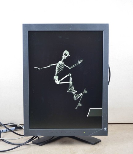 Moniteur lcd ips médical - moniteur,