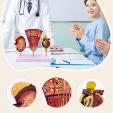 Modèle Anatomique De Rein En PVC Pour Cabinet Médical, Présentoir Et