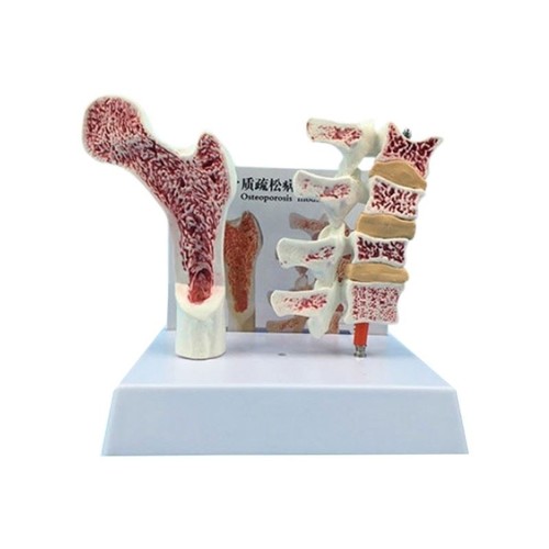 Humain anatomie ostéoporose - humain,
