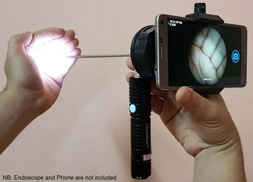 Adaptateur endoscope pour - adaptateur,