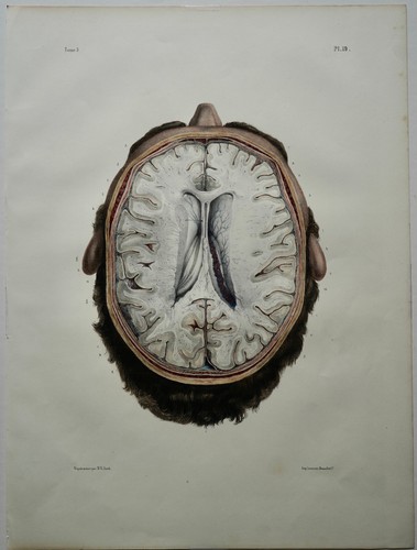 Bourgery jacob anatomie 1844 - bourgery,