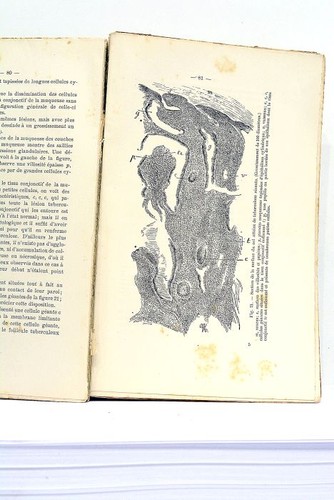 Livre ancien medecine - ancien,