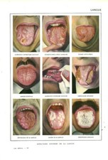 Cabinet of Curiosity Human Anatomy Affections Language Book From