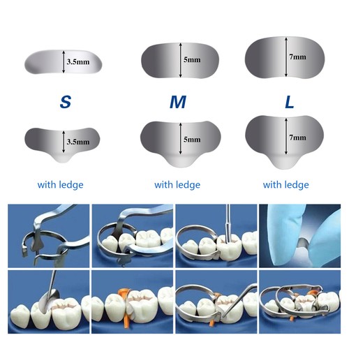 Dental sectional matrix system - sectional,