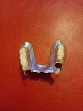 Prothese Dentaire Ancienne