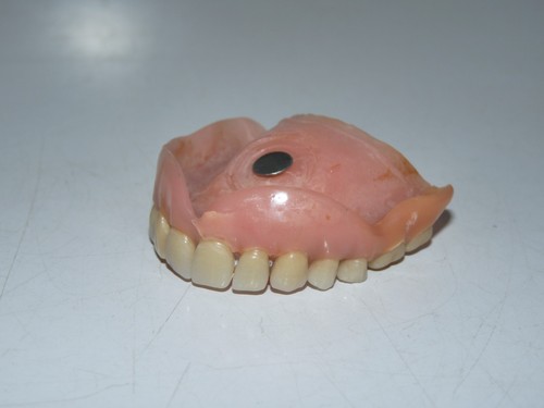 Ancien dentier prothèse