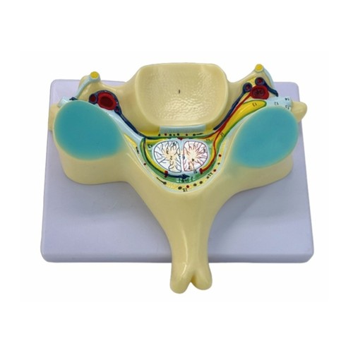 Enlarged fifth cervical spine - fifth,