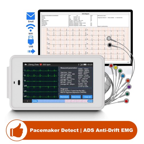 Lead mobile ecg machine w - mobile,