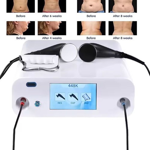 448k tecar therapy indiba - tecar,
