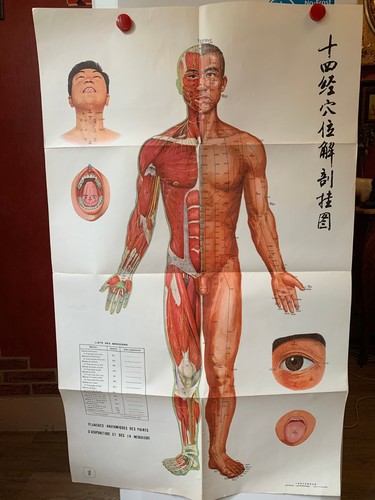 Ancienne affiche medicale - affiche,
