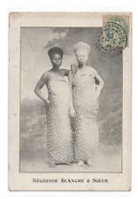 Africa . women's albinos. Curiosity, phenomenon