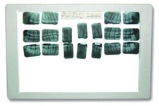 TPC XV100 Dental LED X-ray