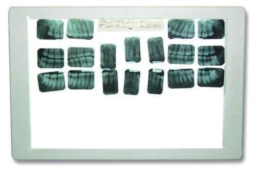 Tpc xv100 dental led - dental,