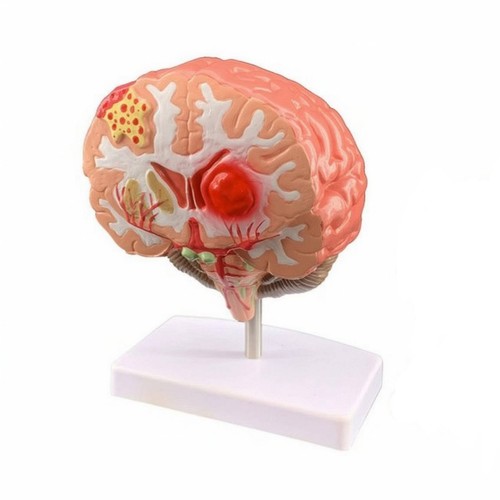 Cerveau réaliste modèle - réaliste, de