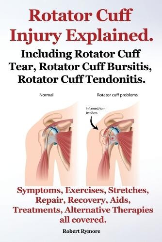 Robert rymore rotator - rotator, cuff