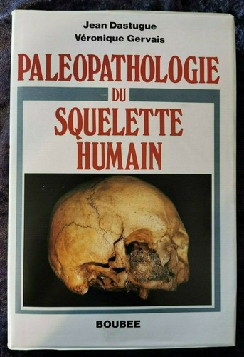 Paléopathologie squelette - paléopathologie,