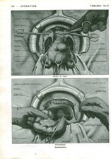 Cabinet of Curiosities Human Anatomy Operation Hysterectomy Book Issue 1952