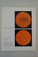 HUMAN ANATOMY BOARD L'OEIL ATLAS Dr SOBOTTA MEDICINE SCIENCE